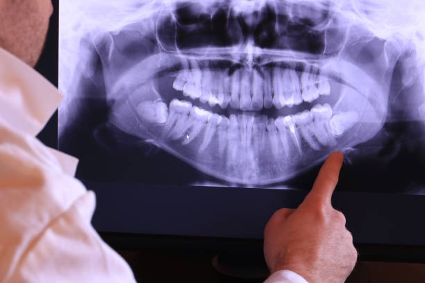Best Emergency Dentist for Special Needs Patients in Keokuk, IA