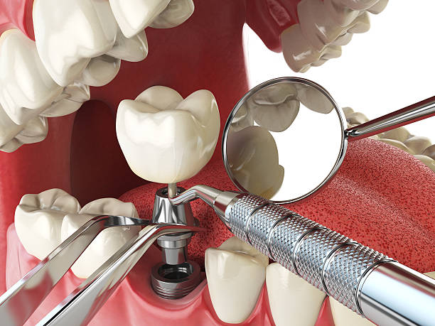 Best Urgent Dental Care for Toothache in Keokuk, IA